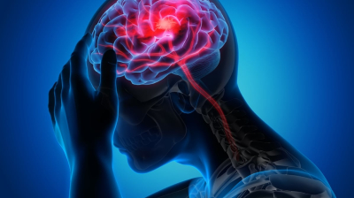 السكتة الدماغية.. ما هي أعراضها وكيف نتجنب مخاطرها؟