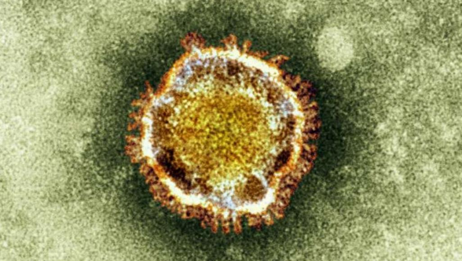 لماذا أطلق على فيروس كورونا هذا الاسم؟