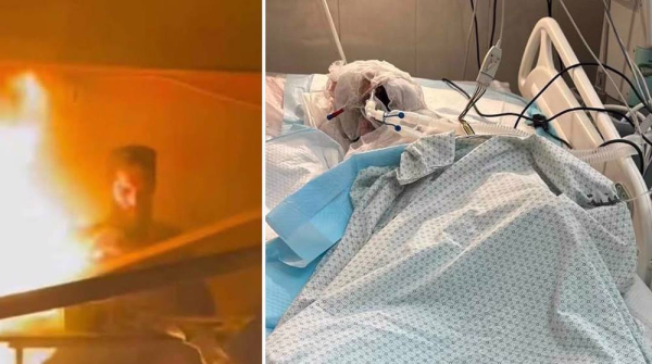 Palestinian reporter dies from burns sustained in Israeli strike on journalist tent in Gaza