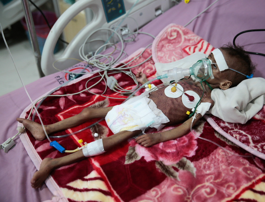 Shocking New Figures Show How Just Much the US is Fueling the Violence in Yemen