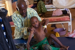 افزایش نگران کنندۀ میانگین سوء تغذیه در سومالی