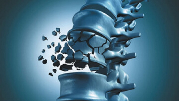 جلوگیری از پوکی استخوان با مصرف این ماده غذایی