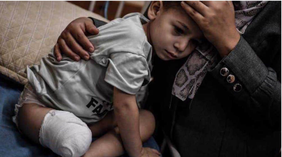 Faute de prothèses, les personnes amputées de Gaza, dont de nombreux enfants, luttent pour retrouver un peu d’autonomie