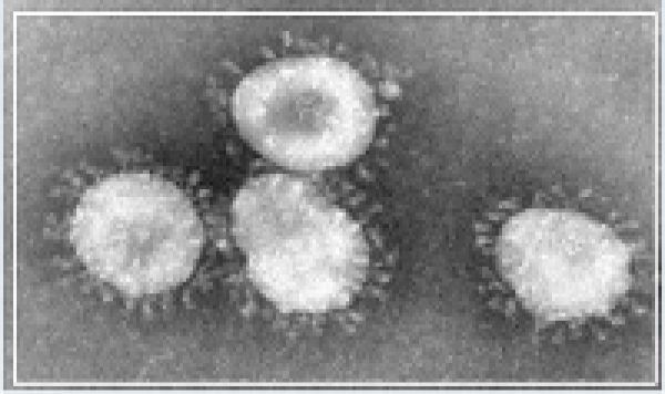Arabie Saoudite: le danger de MER-coronavirus menace