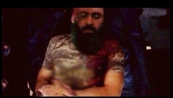 La Mort clinique d&#039;Abou Bakr al-Baghdadi?