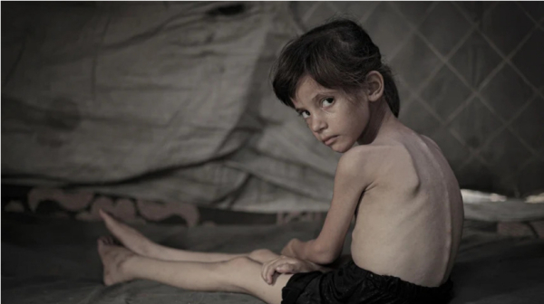Gaza : tous les enfants de moins de cinq ans risquent la malnutrition aiguë, avertit l’ONU