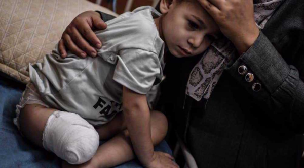 Au moins 21 000 enfants palestiniens vivent avec un handicap causé par la guerre israélienne, selon l’ONU
