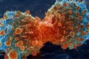 Peneliti Iran Temukan Obat Nano untuk Kanker Bandel